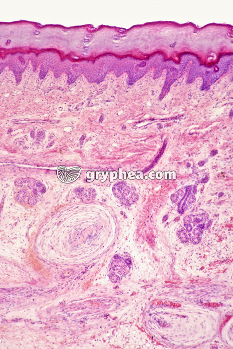 Peau CT Pacini x10 - gryphea.org